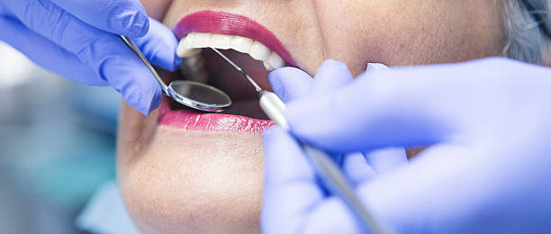 Best Emergency Tooth Extraction in Long Valley, NJ